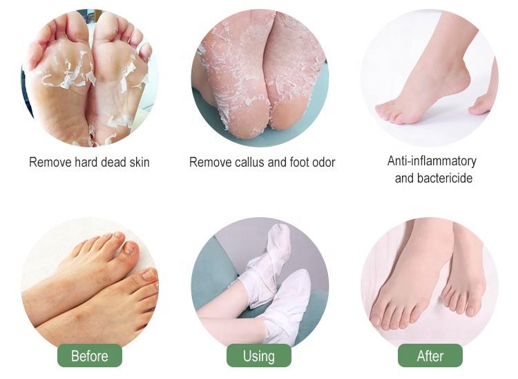 Foot Peel Mask 2 Pack Lavender Exfoliating Foot Mask Booties Moisturizing Socks for Peeling off Calluses and Dead Skin Repairs Rough Heels Foot Care